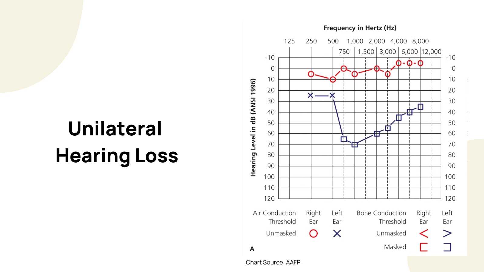 How to read an audiogram dr amy sarow explains